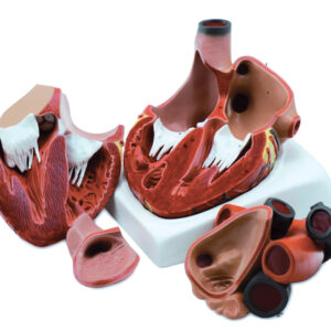 COEUR - 4 pièces - 3X