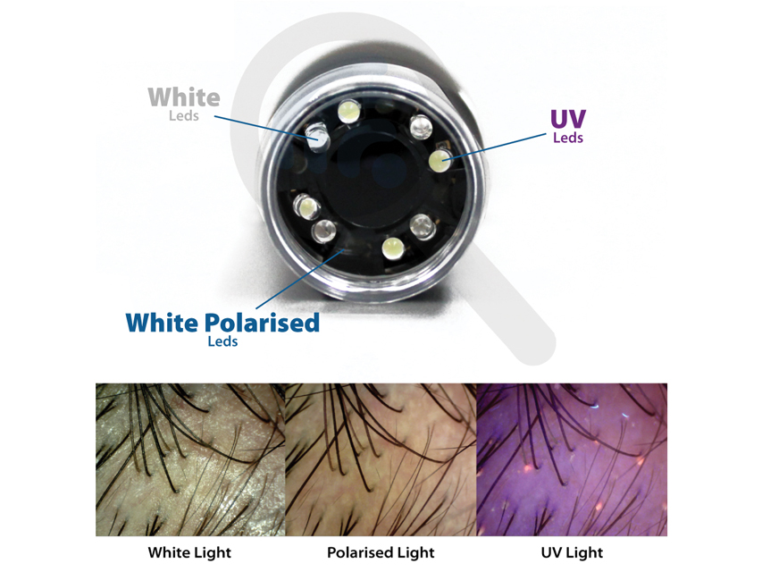 DERMATOSCOPE À LEDs POLARISÉES+UV+BLANCHES MIC Wi-Fi & USB avec logiciel