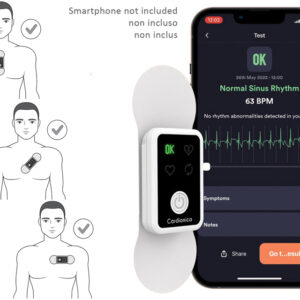 ECG À 1 PISTE CARDIONICA AVEC AFIB et BLUETOOTH