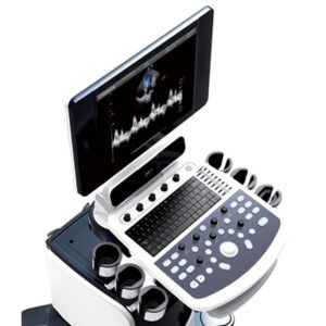 ECHO DOPPLER COULEUR CHISON QBit5