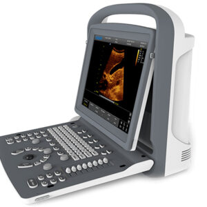 ÉCHOGRAPHE N&B CHISON ECO2 - 1 connecteur de sonde