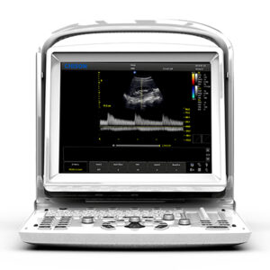 ÉCHOGRAPHE N&B CHISON ECO3 EXP. - 2 connecteurs de sonde
