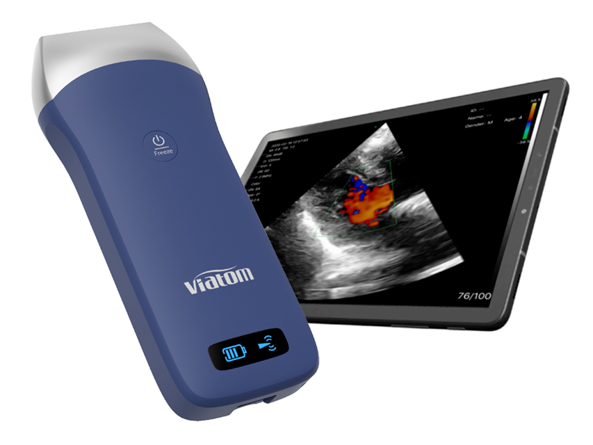 SCANNER PORTABLE LINEAR WIRELESS VIATOM