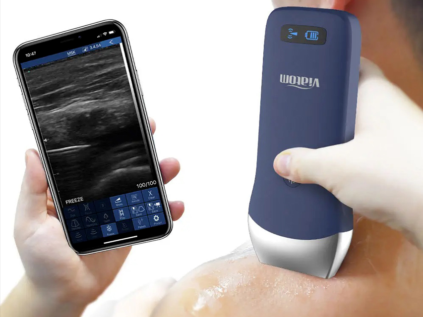 SCANNER PORTABLE LINEAR WIRELESS VIATOM