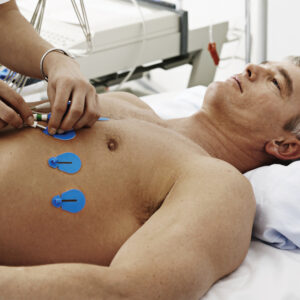 ÉLECTRODES AMBU BLUE SENSOR SU ECG - 4 mm