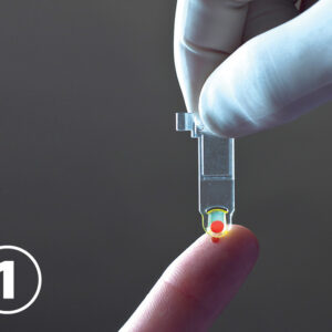 HEMO CONTROL: mésure hémoglobine et hématocrite