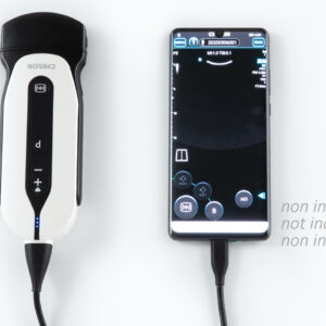 SONOEYE P5 DOPPLER COULEUR NUMÉRIQUE - Sonde Convex