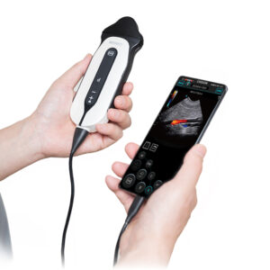 SONOEYE P6 DOPPLER COULEUR NUMÉRIQUE - Sonde Micro-Convex