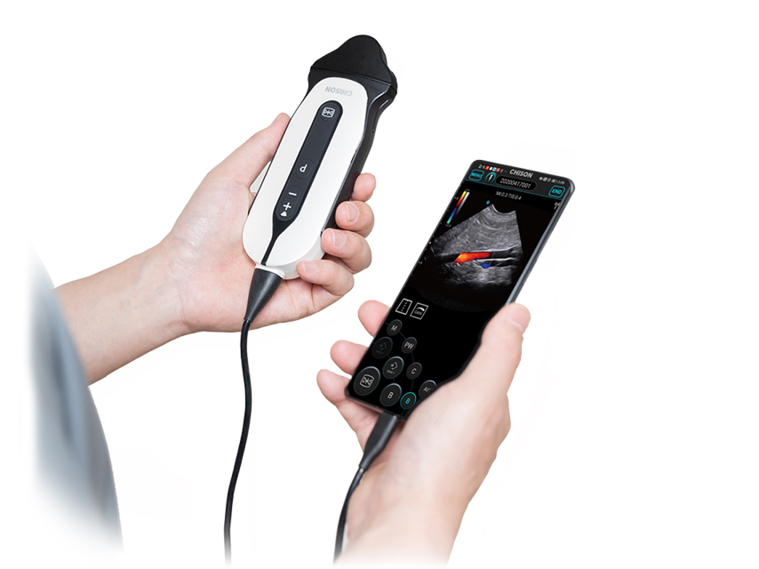 SONOEYE P6 DOPPLER COULEUR NUMÉRIQUE - Sonde Micro-Convex