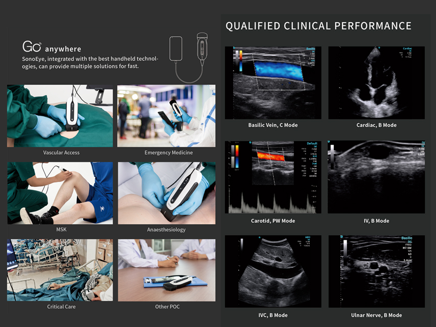 SONOEYE P6 DOPPLER COULEUR NUMÉRIQUE - Sonde Micro-Convex
