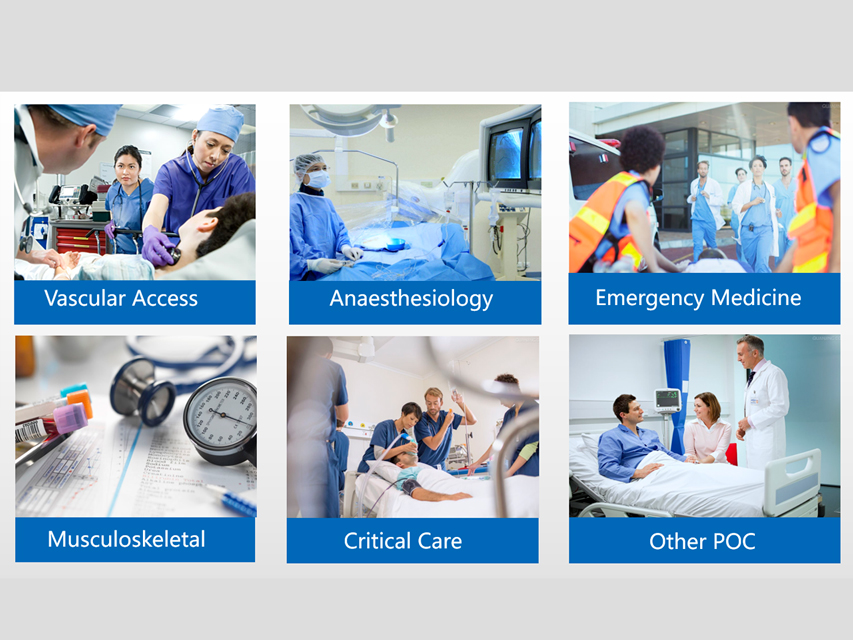 SONOEYE P6 DOPPLER COULEUR NUMÉRIQUE - Sonde Micro-Convex