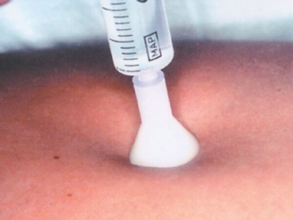 Traitement Par Injection Cutanée 31g 0,26x2,5 Mm - Blanc - NIMEDIX MEDICAL