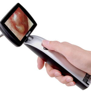 VIDÉOTOSCOPE MD SCOPE MS102- PACK ELITE
