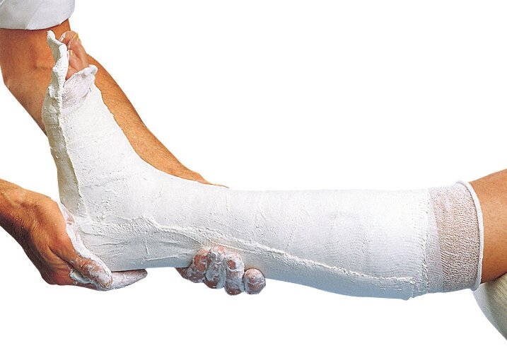 Bande Plâtrée Prise Normale Cellona® L. 3 m x l. 10 cm