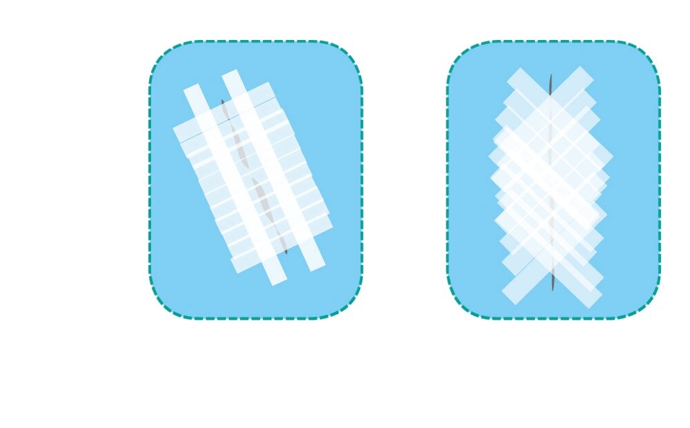 Suture 3M™ Steri-Strip™ – Image 5